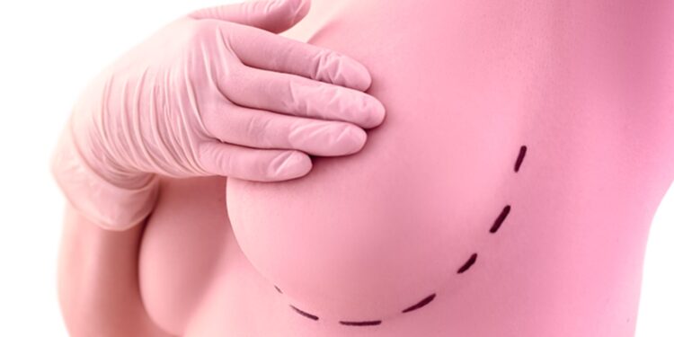 Foto: Reprodução/ Instituto Peito aberto