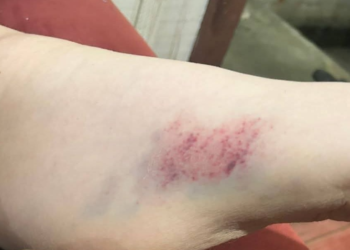 Foto: Página Hashtag Morretes