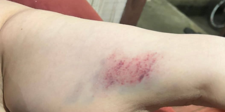 Foto: Página Hashtag Morretes