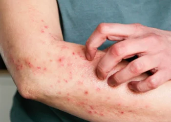 Foto: Kinga Krzeminska/GettyImages