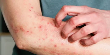 Foto: Kinga Krzeminska/GettyImages