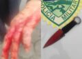 Briga familiar termina com golpes de faca, mordida e ferimentos em Morretes