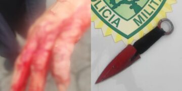 Briga familiar termina com golpes de faca, mordida e ferimentos em Morretes